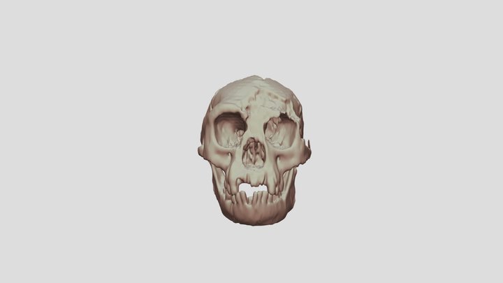 Homo Floresiensis CT SCAN