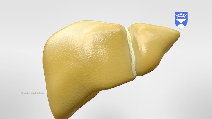 Fatty Liver 3D Model