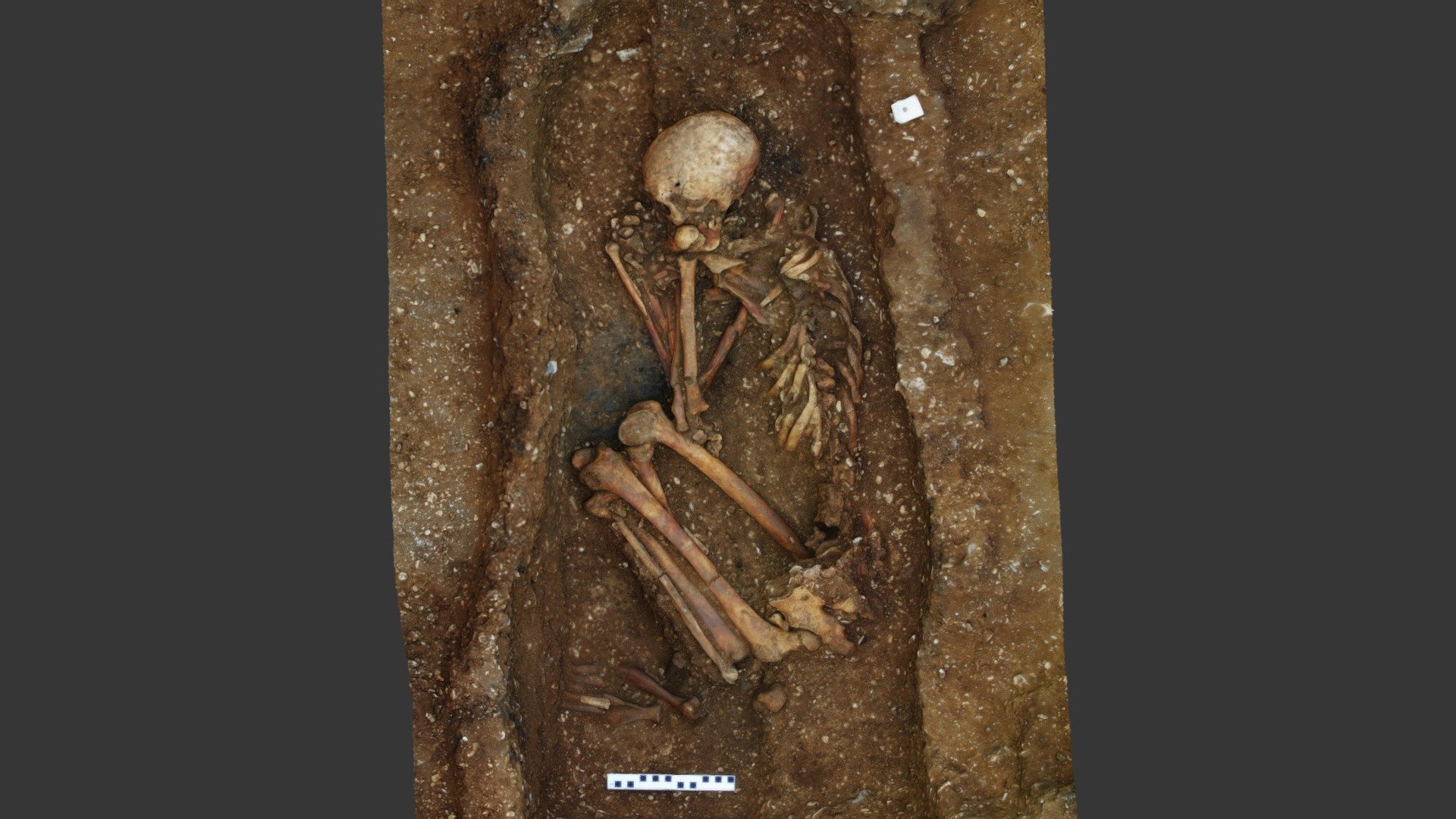 Sigma-MAP-CB-Pock-Burial