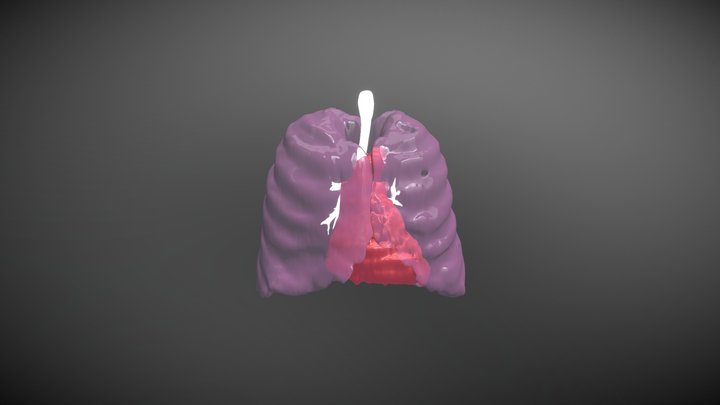 Lungs, Airway, Heart and Aorta Segmentation 3D Model