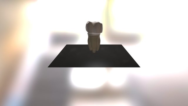 DENTAIRE bring 3D Model
