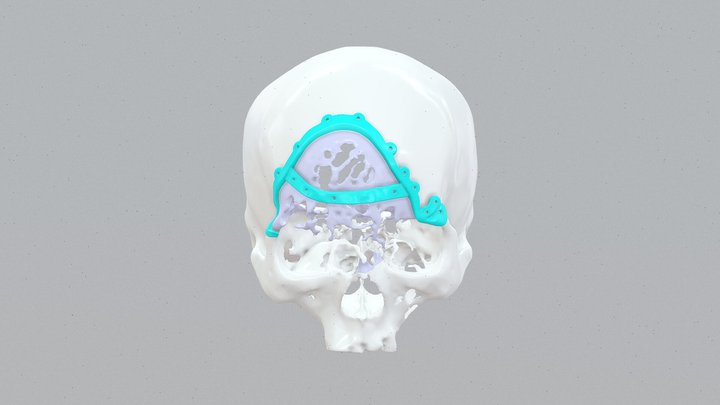 20260207-01 3D Model