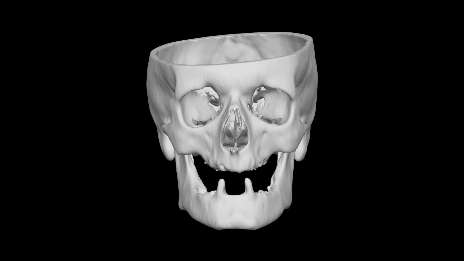 Skull Male 55yo