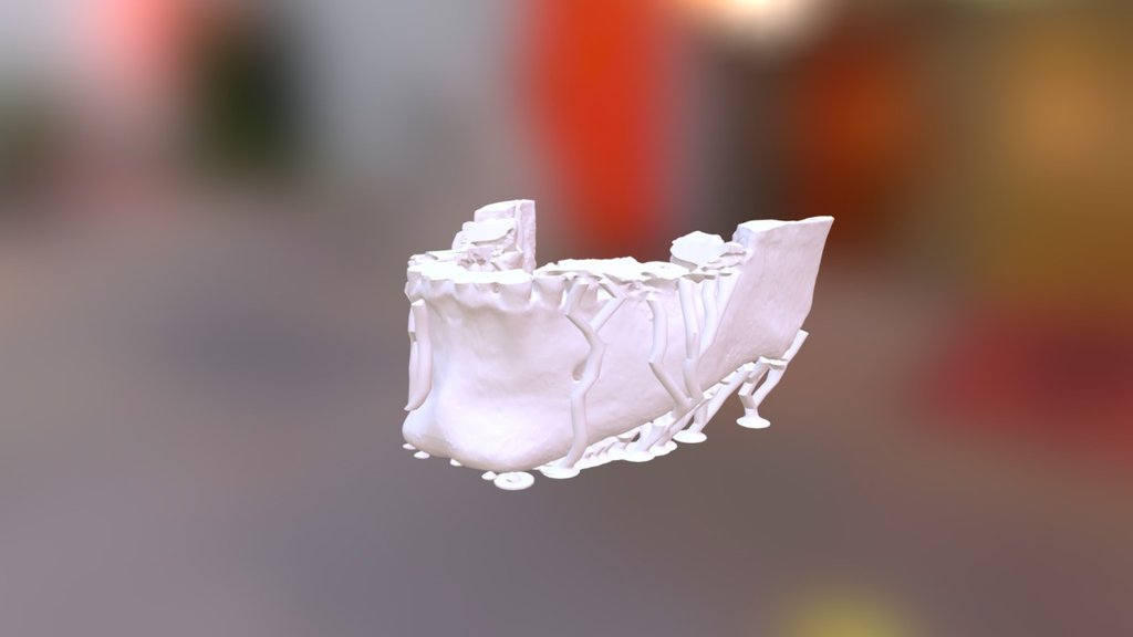 Mandible3
