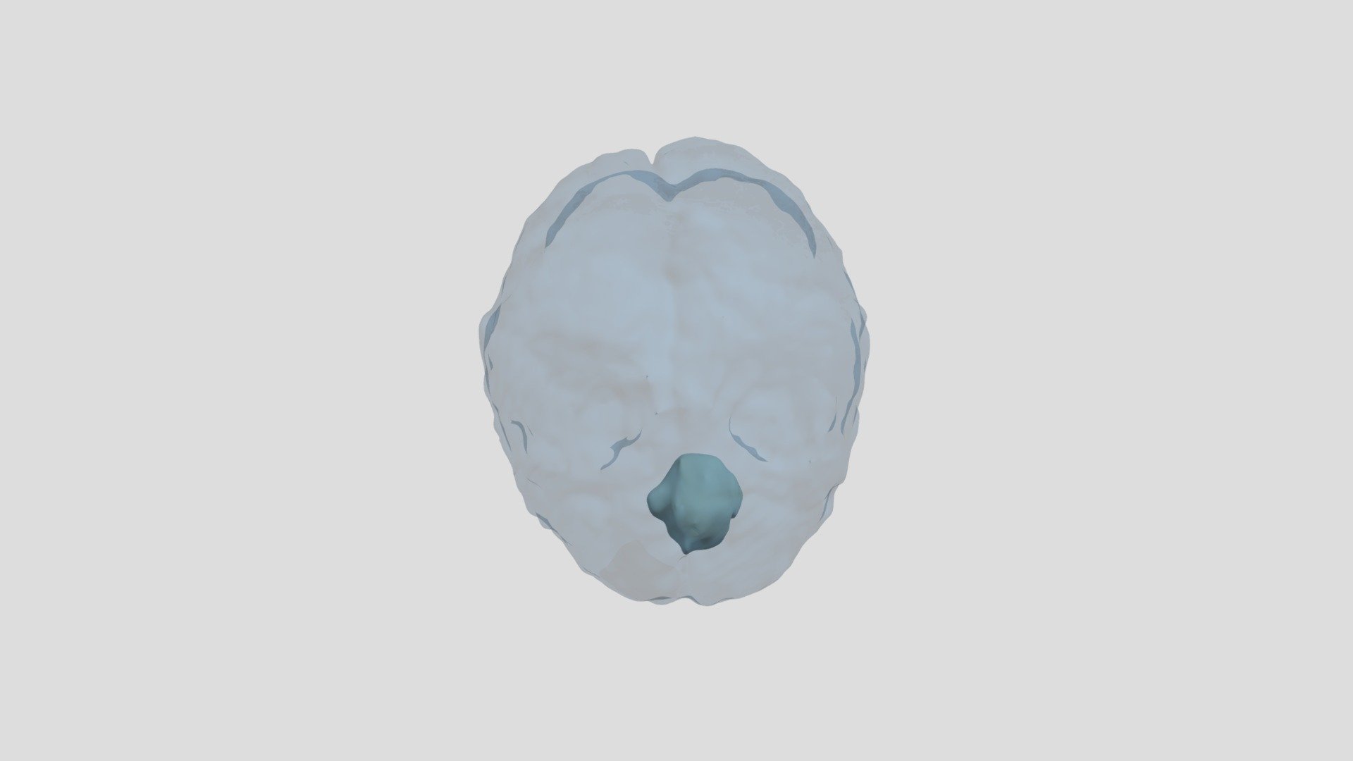 Tumor Segmentation