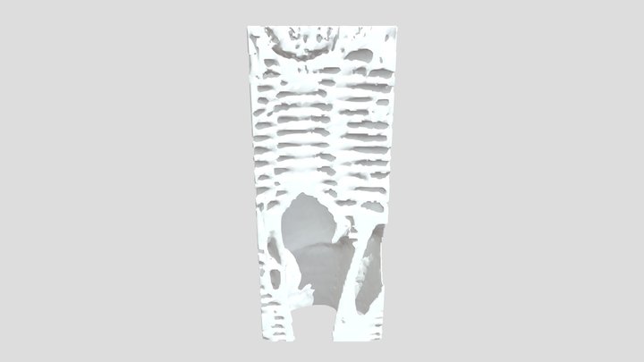 Anatomy of pernambuco wood Paubrasilia echinata
