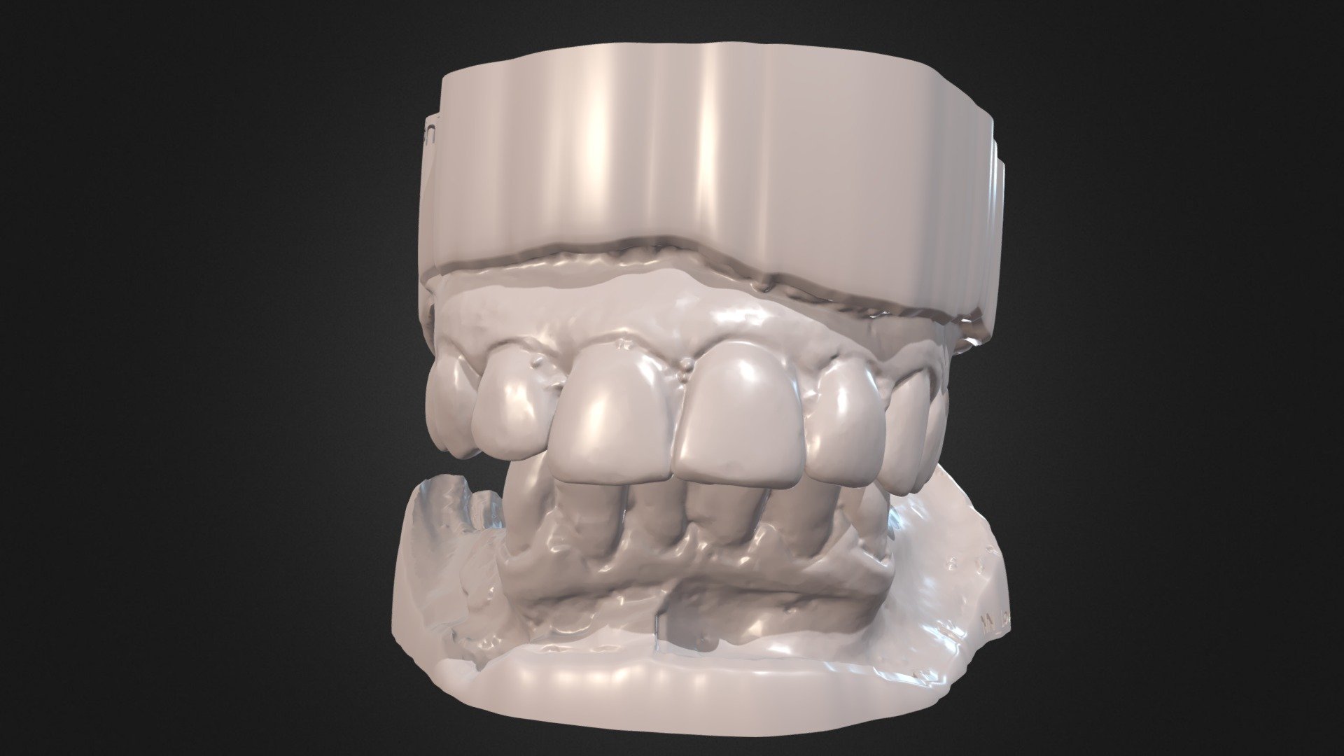 Occlusion Case NN
