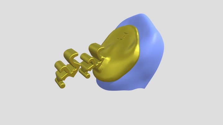 Orthodontic Lingual Bracket 3D Model