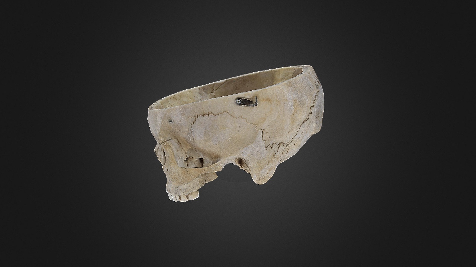 Human Cranium