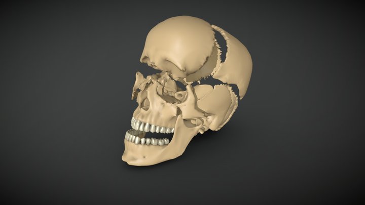 CrackedHumanSkull 3D Model