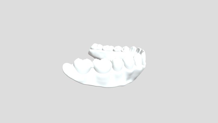 Denture_1 3D Model