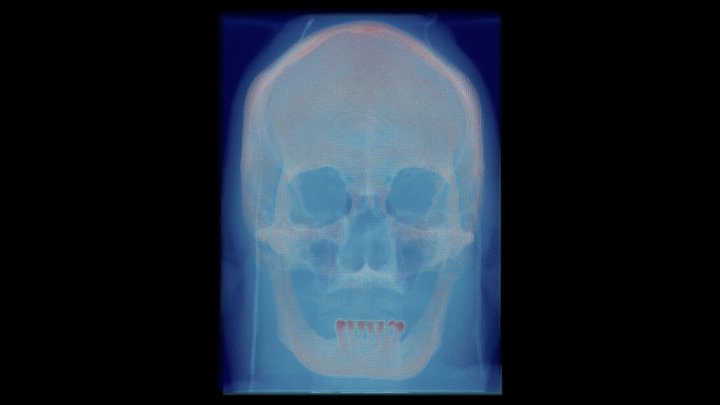 Full CT Head Point Cloud--Visible Human Female 3D Model