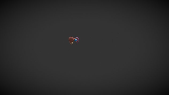 Abdominal CT 3D Model