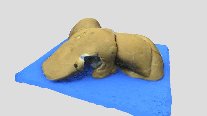 Liver 3D Model