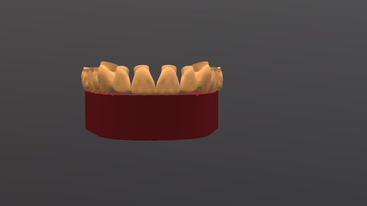 1_upper teeth on lower occ rim 3D Model