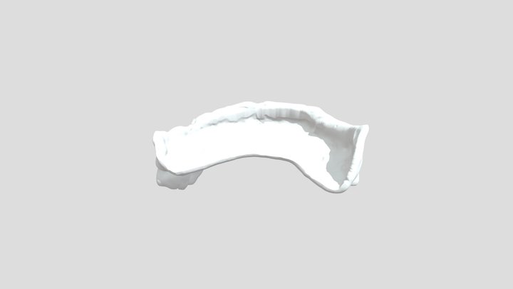 Denture_3 3D Model