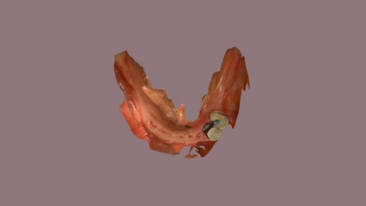 Mandibular digital impression 3D Model