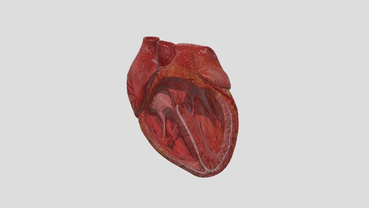 Heart Mitral Stenosis 3D Model