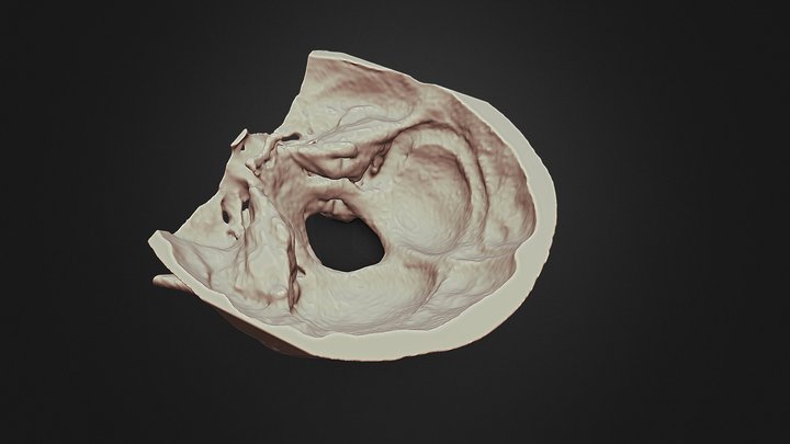 Occipital Bone Biomodel by CT Scan 3D Model