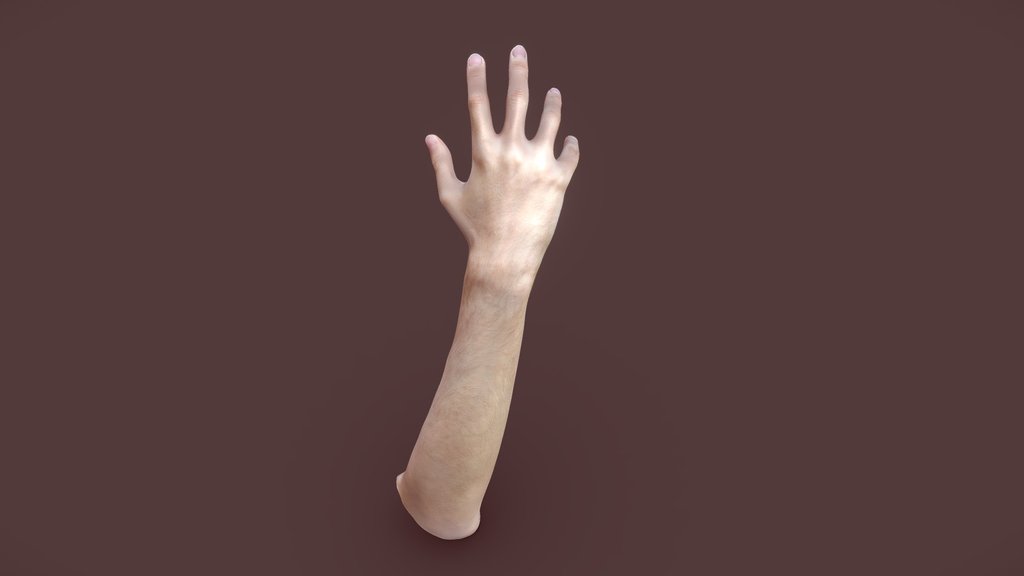 Arm