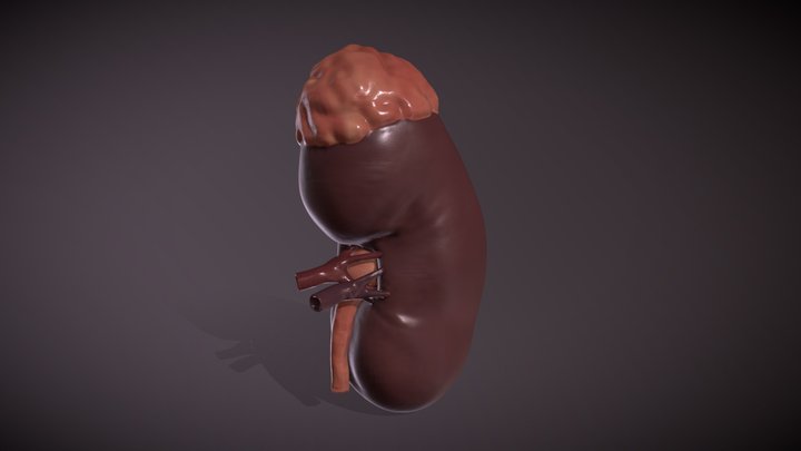 Kidney 3D Model