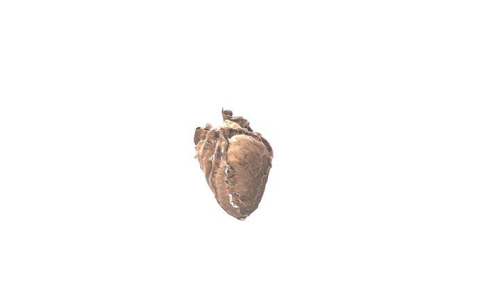 Normal Heart - Left Dominant Coronary Pattern 3D Model
