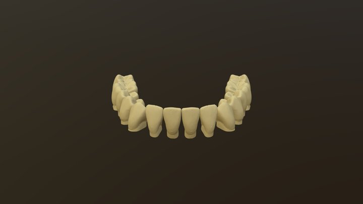 4_lower teeth alignment 3D Model