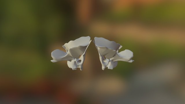 Split Sphenoid 3D Model