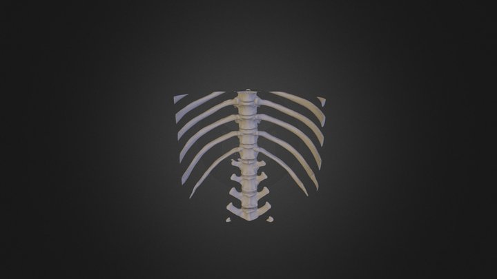 Discal Hernia L1-L2 3D Model