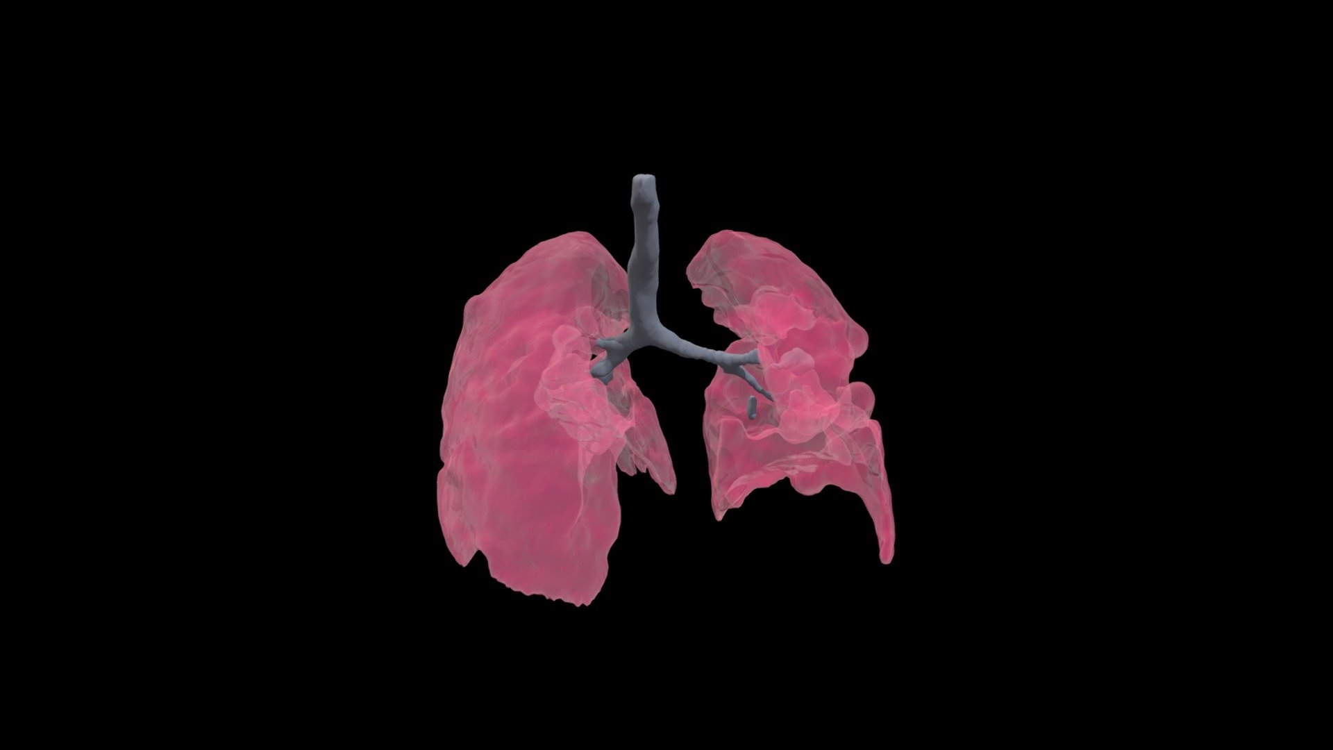 Female Diseased Lungs - 3D model by iiambahii3 [7785d61] - Sketchfab