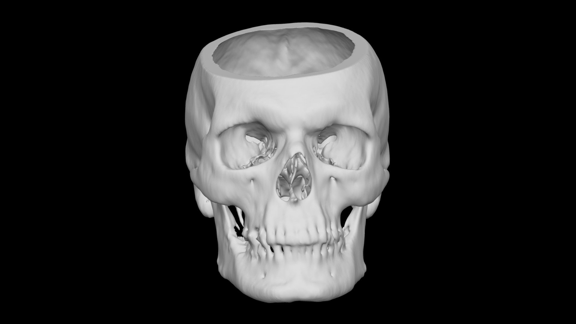 Skull Male 69yo