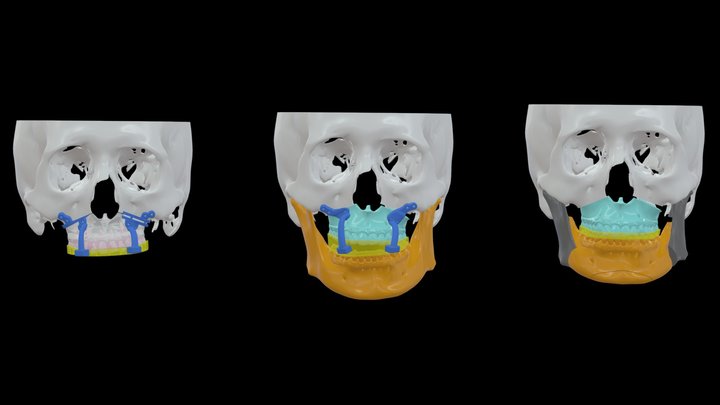 Dr.許-李O緹-0130 3D Model