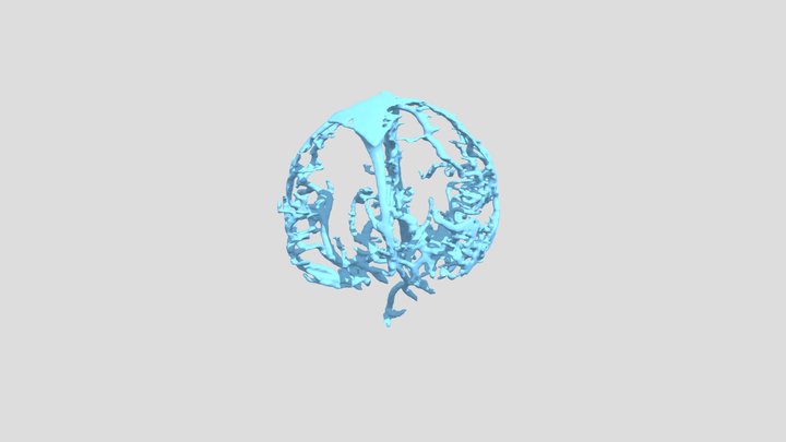 Artery 3D Model