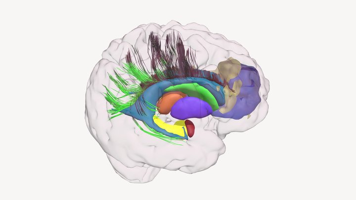 Brain with subcortical structures and tracts 3D Model