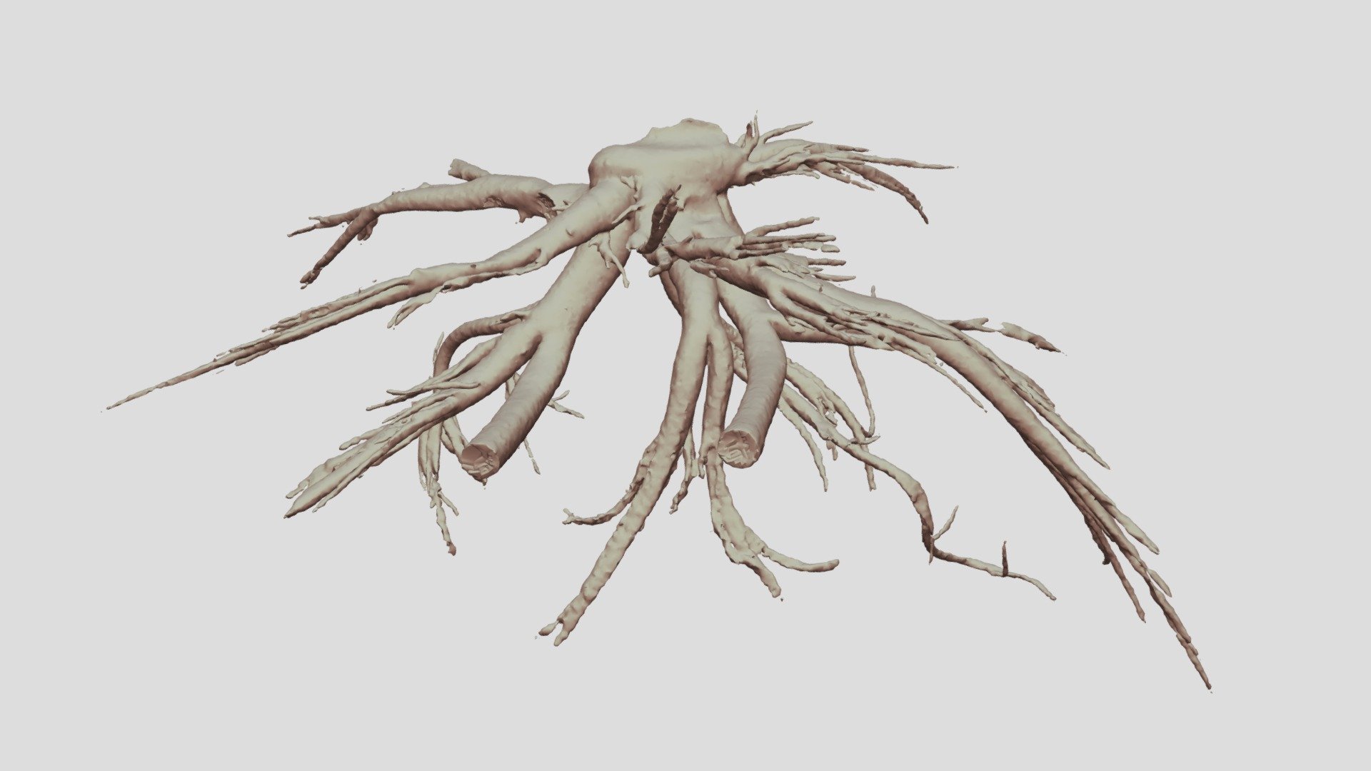Cacosceles newmannii larva tracheae. Sample Nr5