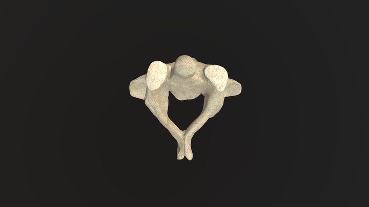 Vertebra Axis / Axis Vertebrae (C2) – Free 3D Model STL