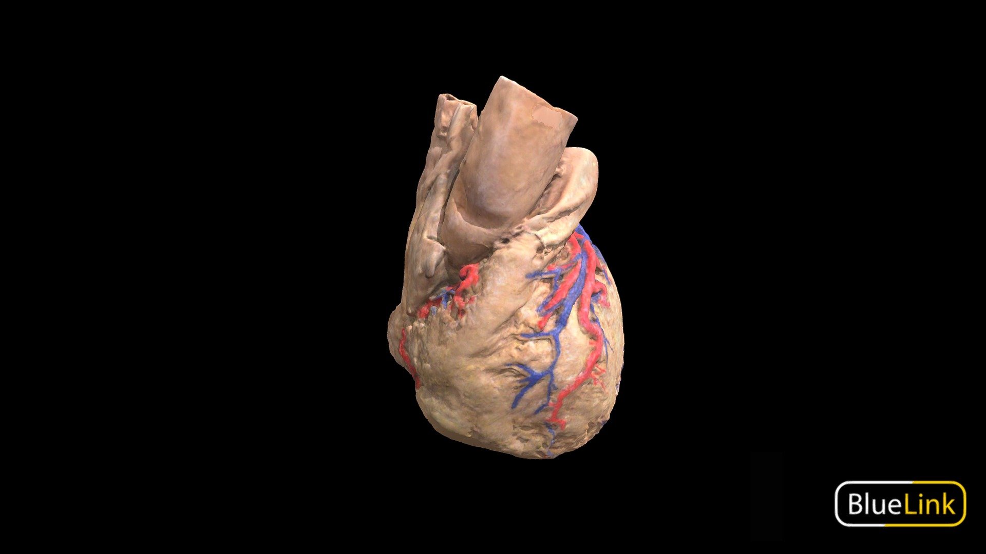 External Heart Vasculature - 3D Model By Bluelink Anatomy - University ...