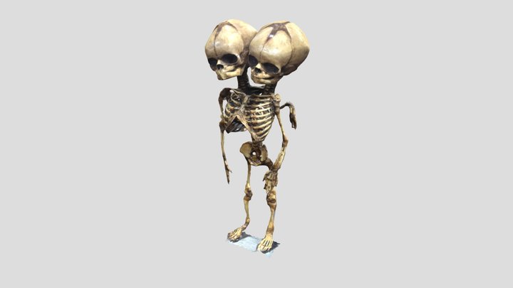 Conjoined Skeleton 3D Model
