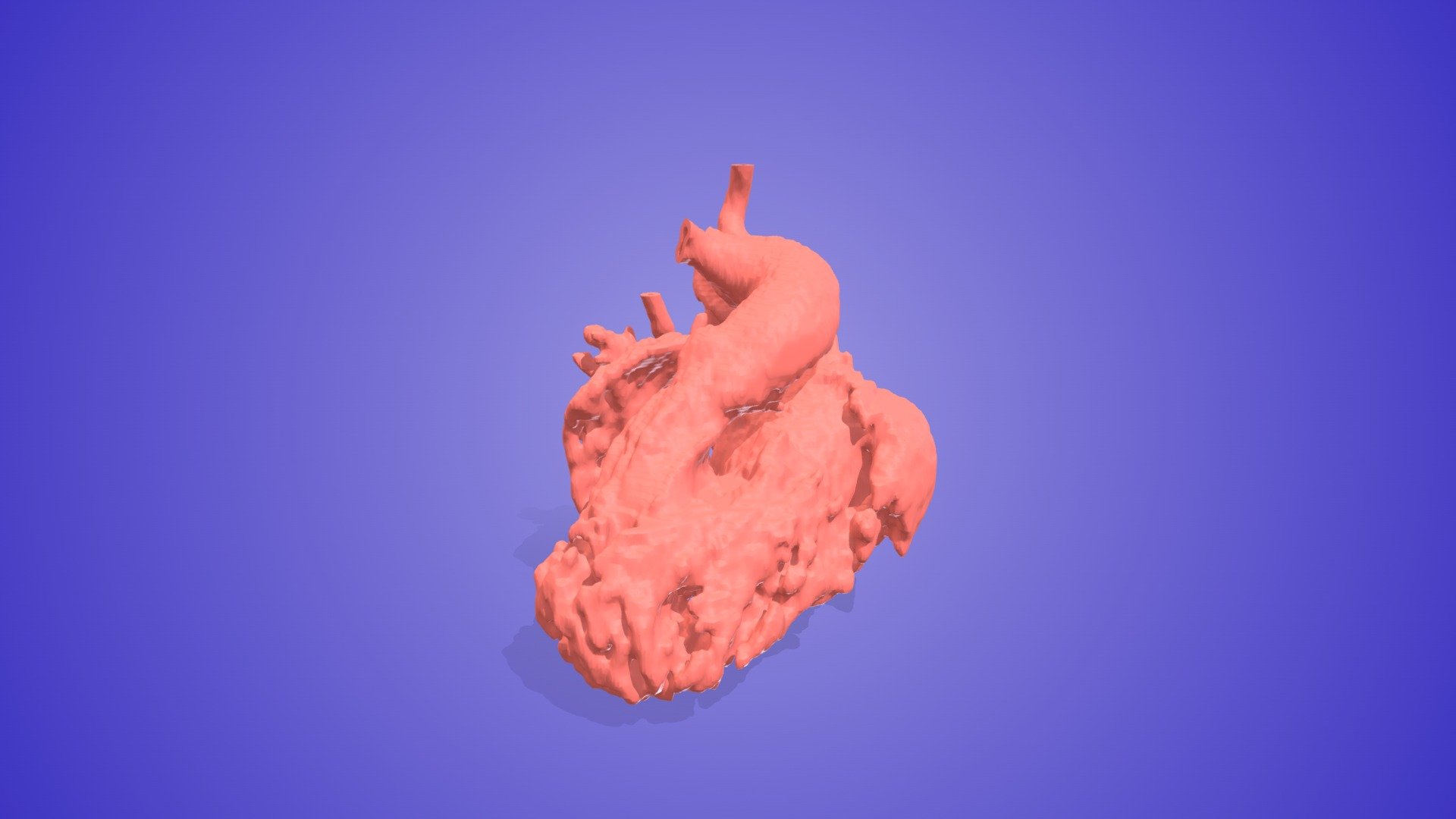 Univentricular