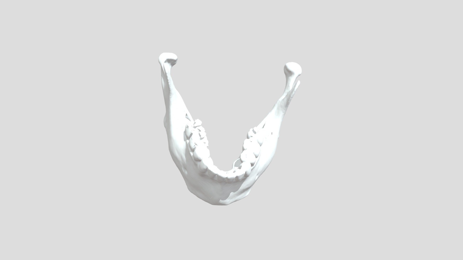 MANDIBULE MESH