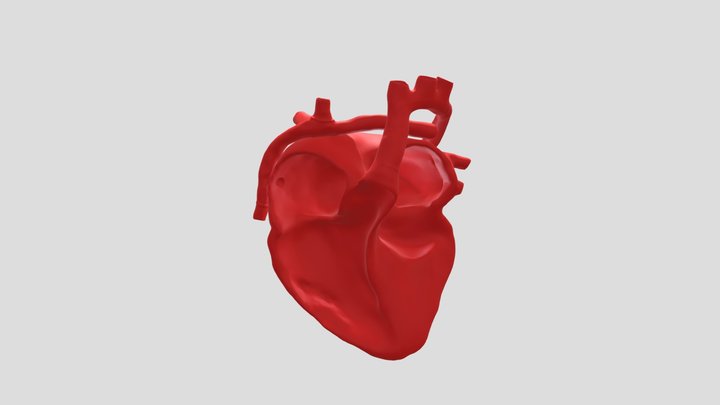 Extracardiac Post Fontan 3D Model