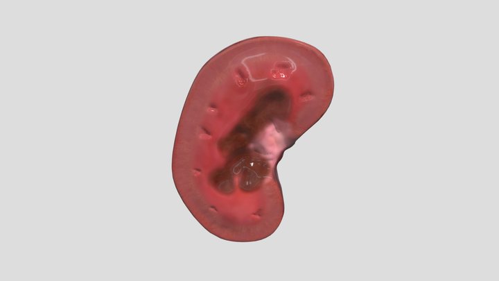 Papillary Necrosis (Veterinary Pathology) 3D Model
