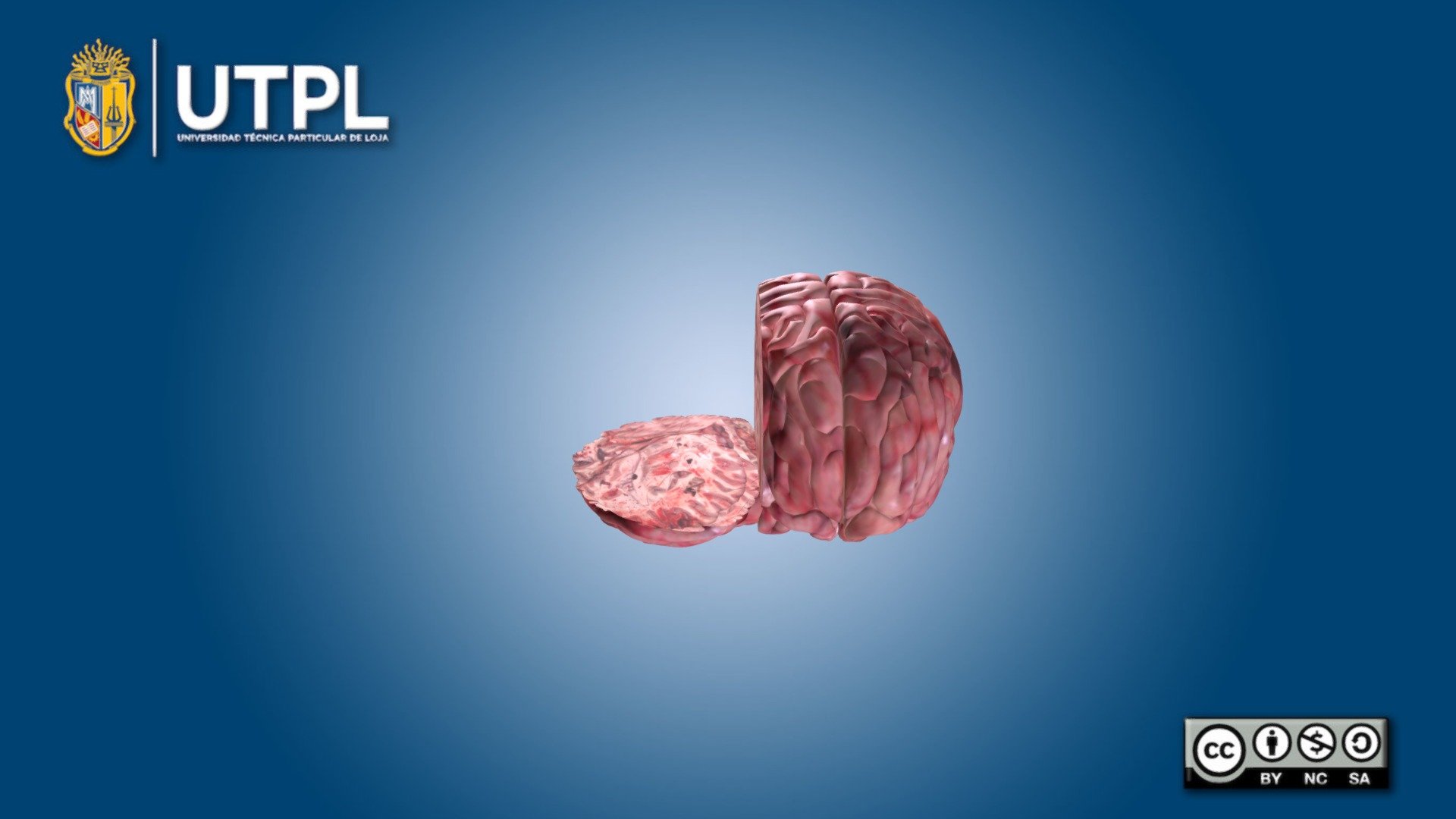 cerebro_ahorcado_nuevo