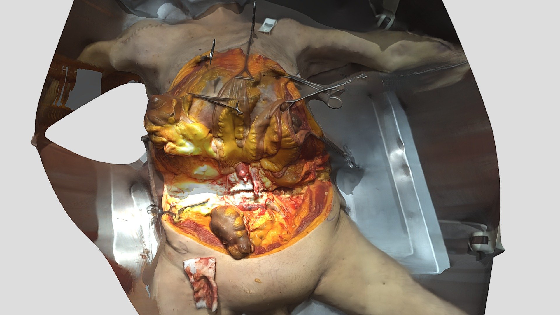 Anatomical dissection
