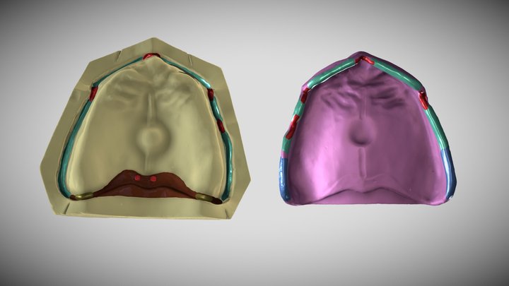 Maxillary Border Limiting Structures 3D Model