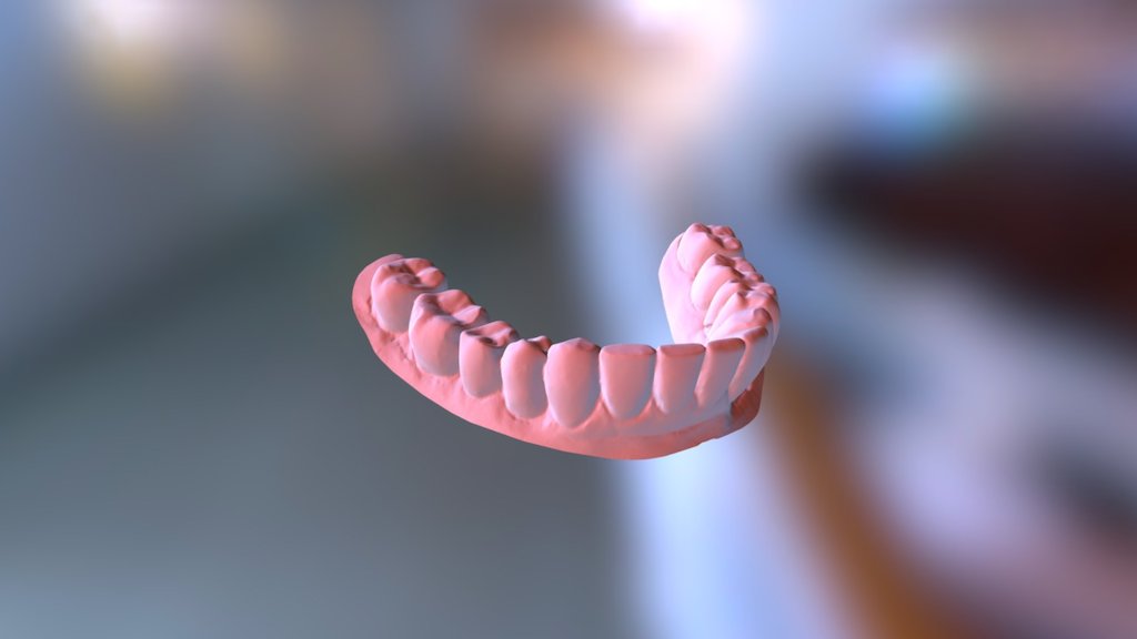 Bernie Lower Jaw