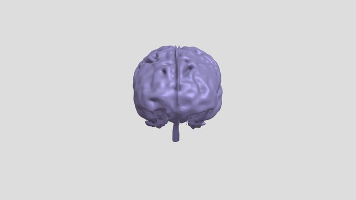 Segmentation_Brain 3D Model