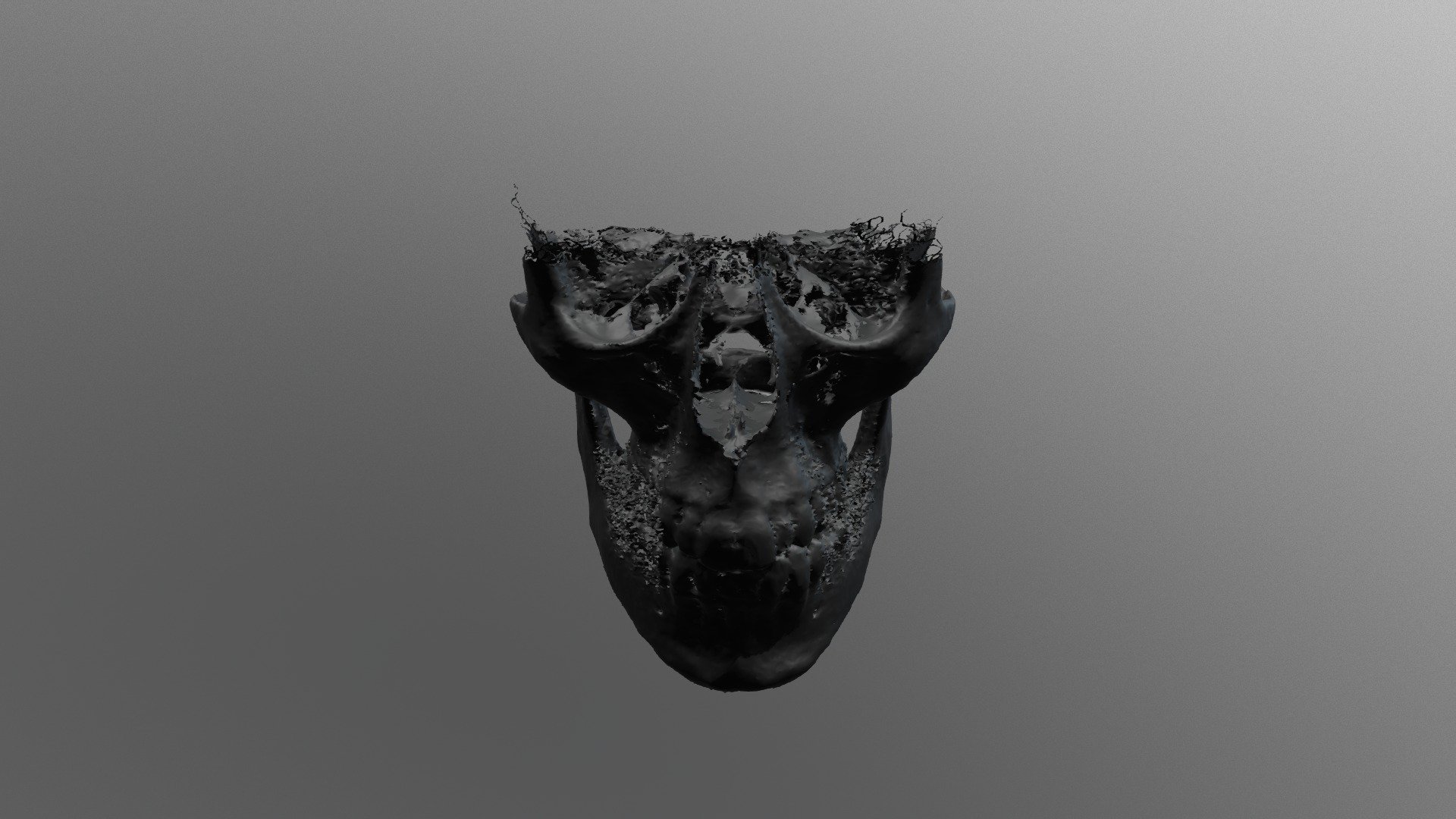 Bone5
