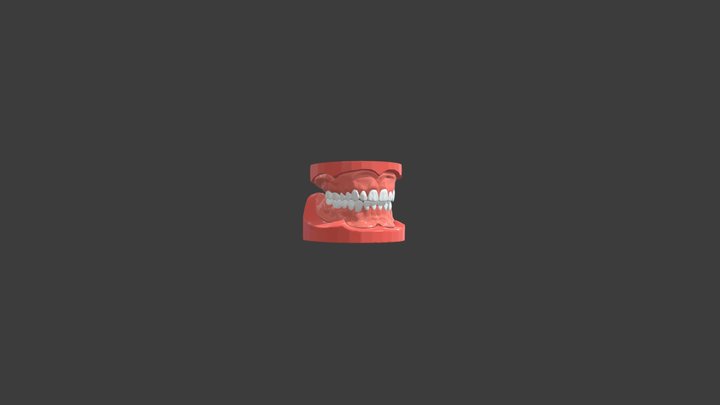 Opposing Arches with Dentures 3D Model