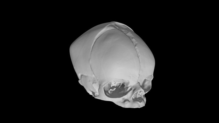 Human Fetal Skull v.2